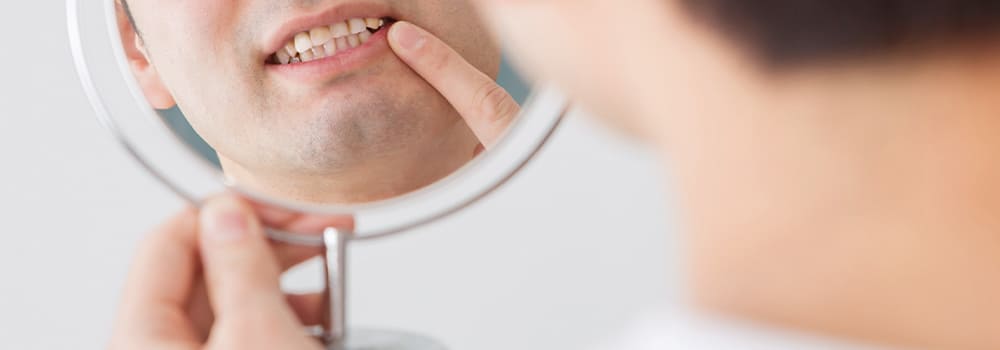 鏡で歯をチェックする人のイメージ