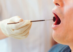 歯石とり・口腔衛生指導
